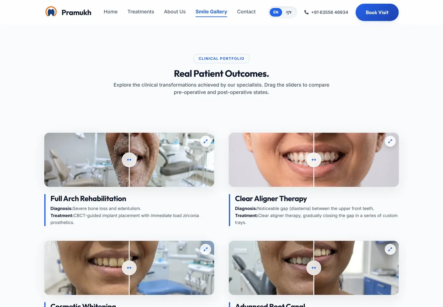 The smile gallery page, headed Real Patient Outcomes, showing before-and-after cases in a grid with a drag handle across each image and the diagnosis and treatment written underneath.
